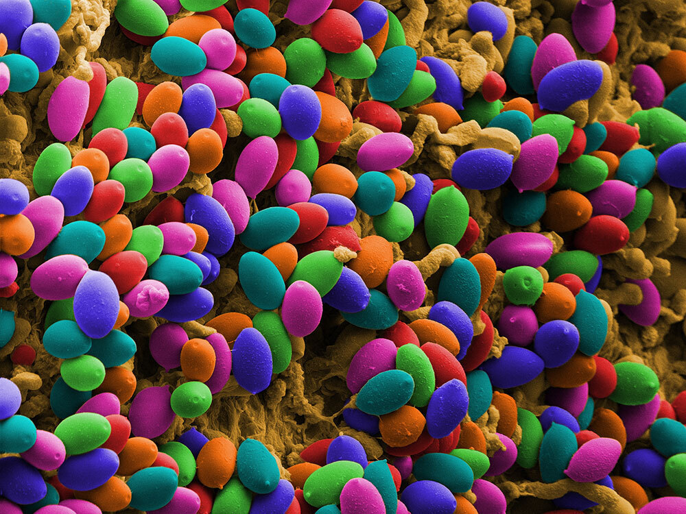 A photo of microscopic mushroom spores