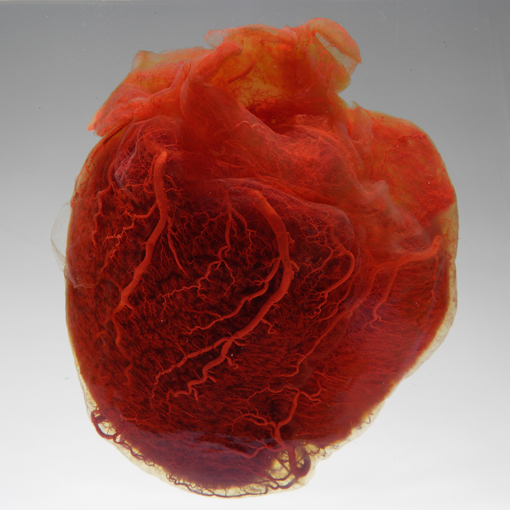 A human heart displayed with the fat stripped away