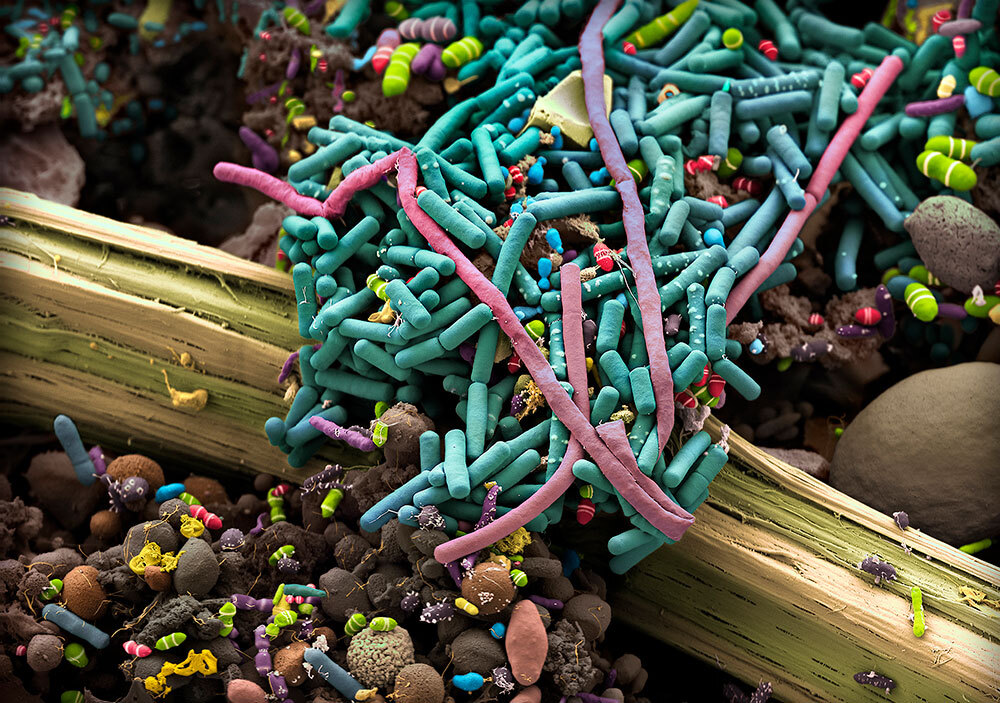 A hand-colored scanning electron micrograph revealing the large number and variability of bacteria present in human excrement