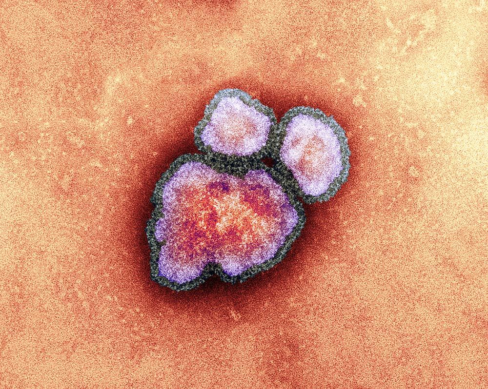 A colored transmission electron micrographic view of measles virus particles, which appear as three amorphous blobs surrounded by grey protein envelopes.