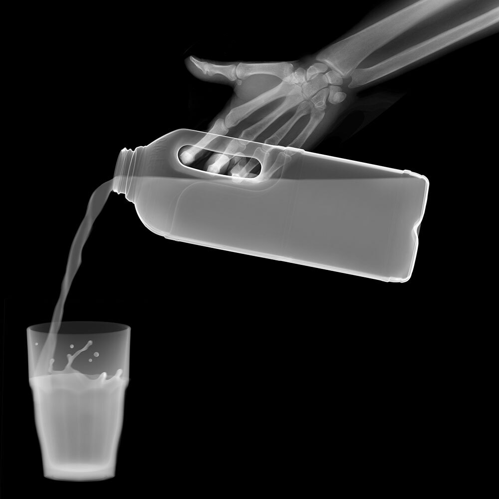 Photo illustration of an x-ray of an arm pouring milk into a glass.