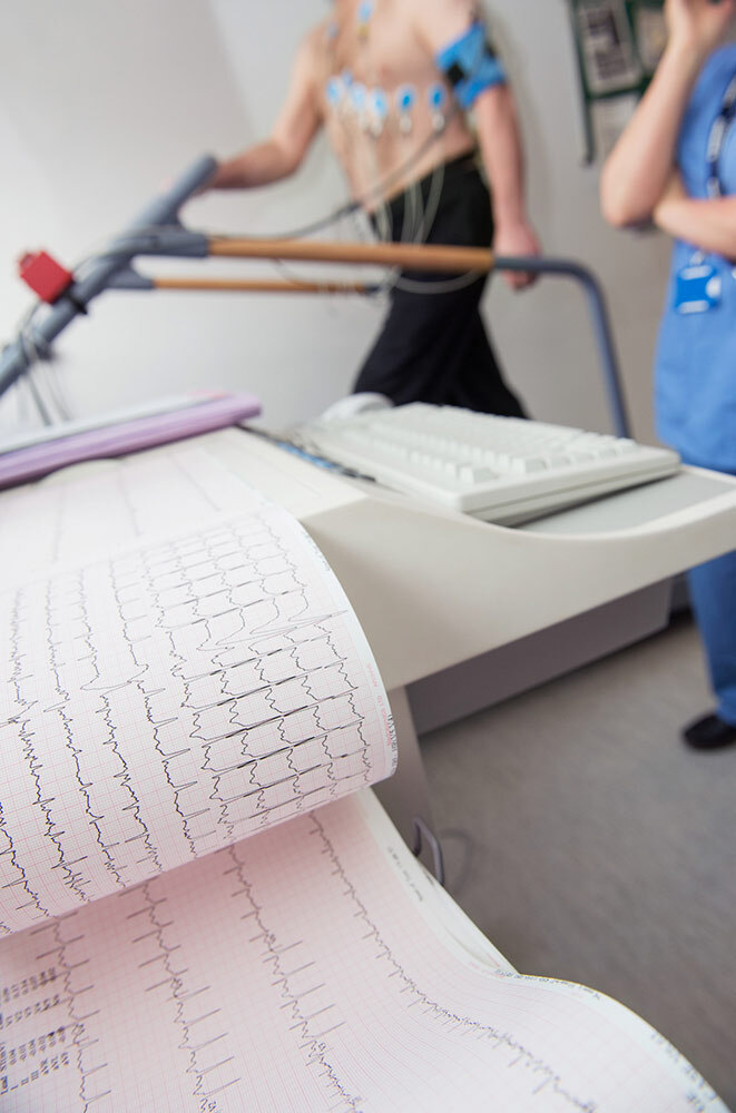 An ECG in the foreground, printing measurements of a patient's heart electrical activity as they exercise on a treadmill, visible in the background.