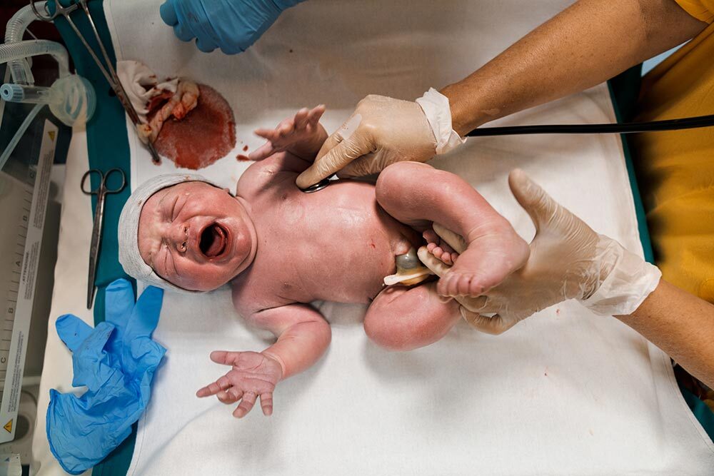 A newborn baby has vital signs checked in a hospital