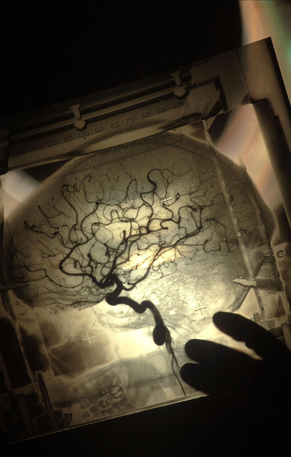 LIght shines through a thin slice of a brain