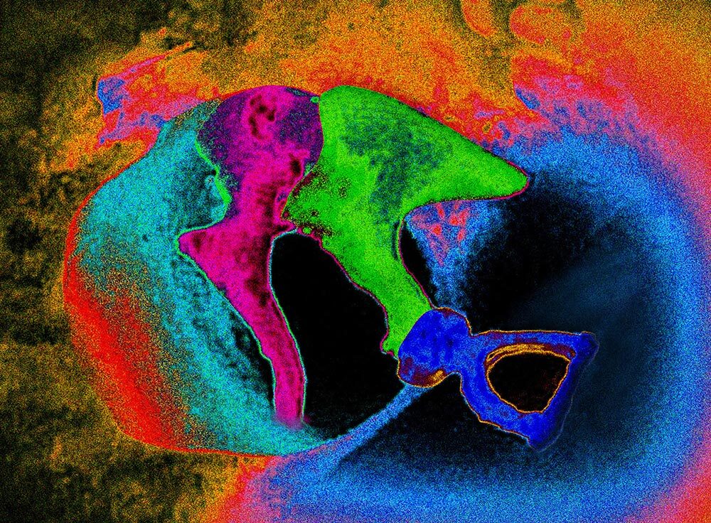 A colorful visualization of the inner ear. In light blue, the tympanic membrane; the malleus in violet, the incus in green, and the stape and round window in royal blue.