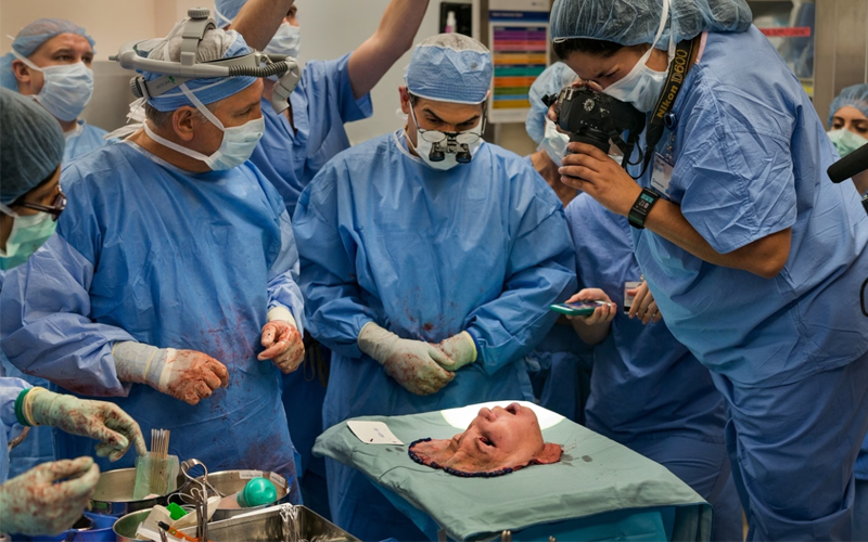 Sixteen hours into a transplant operation at the Cleveland Clinic in Ohio, surgeons finish the intricate task of removing the face from an organ donor. Awed by the sight and by the gravity of their work, the team falls suddenly silent as staff members document the face in between its two lives.  