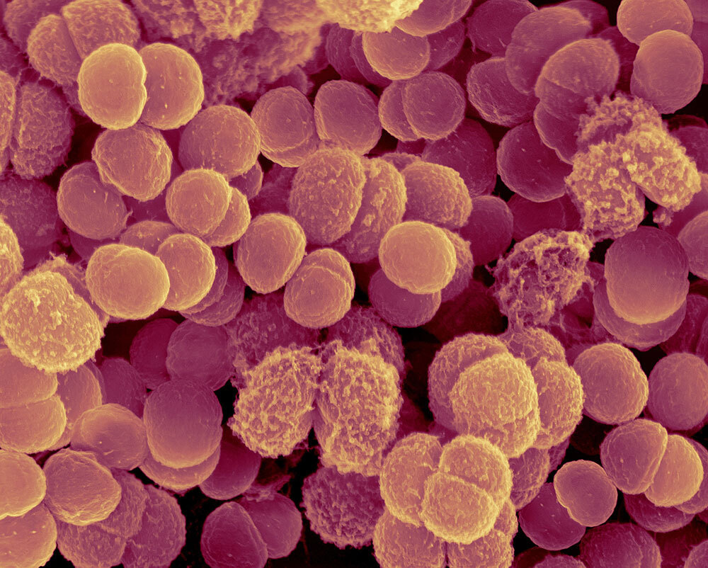 A colored, scanning electron micrograph of bacteria