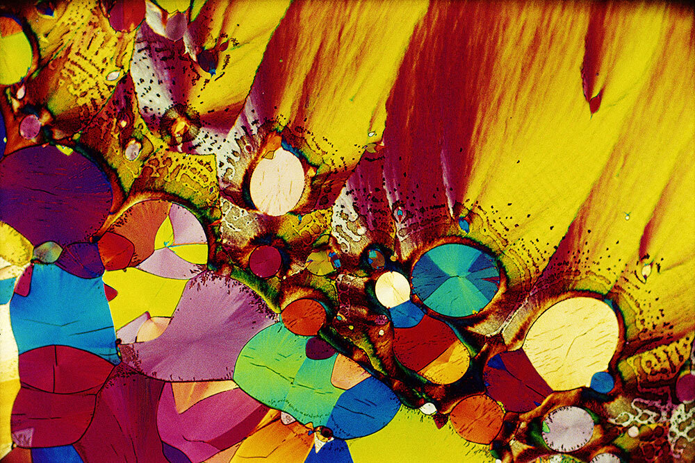 Polarized light micrograph (PLM) of serotonin, also known as 5-hydroxytryptamine.