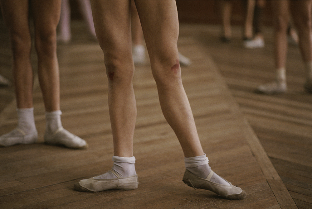 The legs of ballerina dancers during practice; one ballerina's knee is visibly scuffed