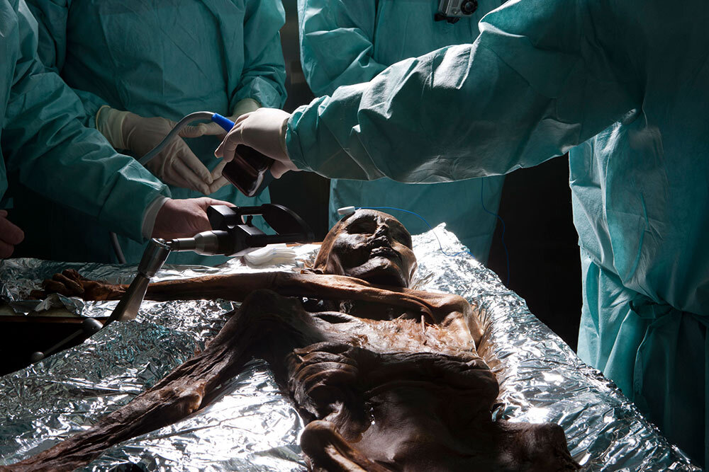 Brain samples are taken from the Copper-Age mummy Ötzi, who was encased in ice shortly after death. This natural mummification preserved the body for some 5,000 years before its discovery in 1991.