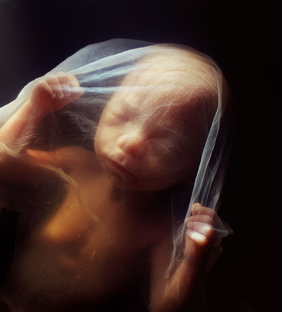 A human fetus floats in the amniotic sac at 18 weeks, receiving all the oxygen and nutrients it requires via the placenta.