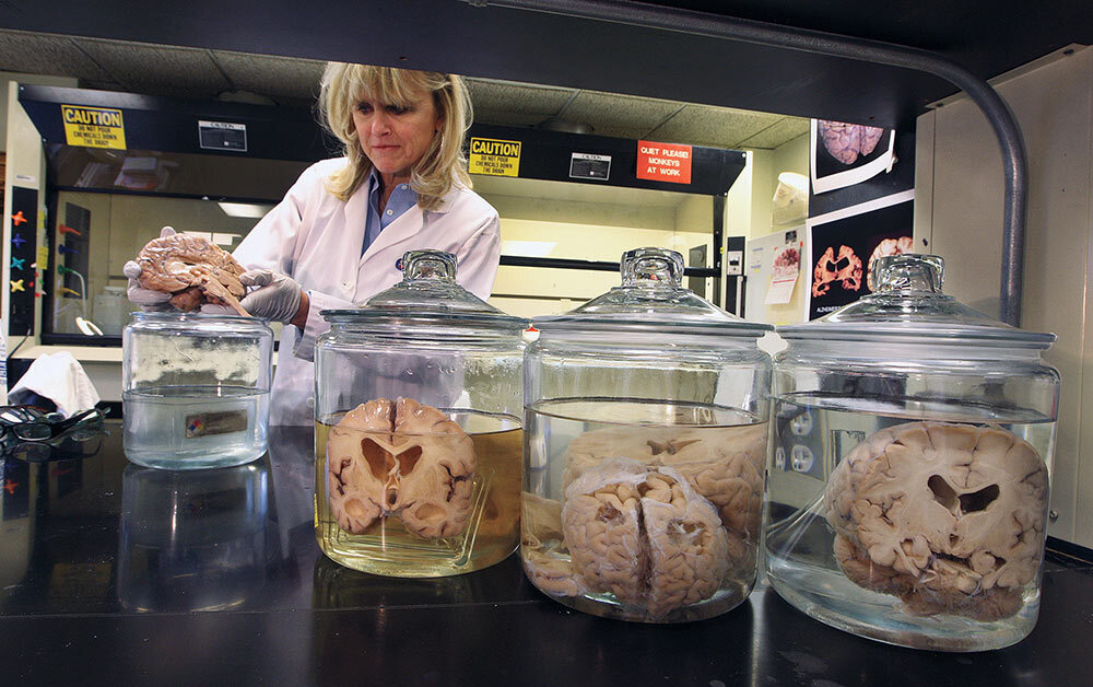 As Ann McKee has toiled away researching the risks of CTE, there has been tremendous resistance to the societal changes her findings suggest are necessary to prevent the disease.