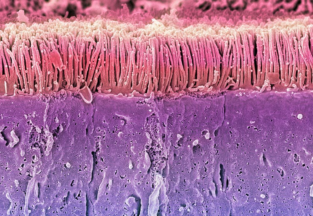 A scanning electron microscope view of intestinal cells (purple), which are covered with microvilli (pink).