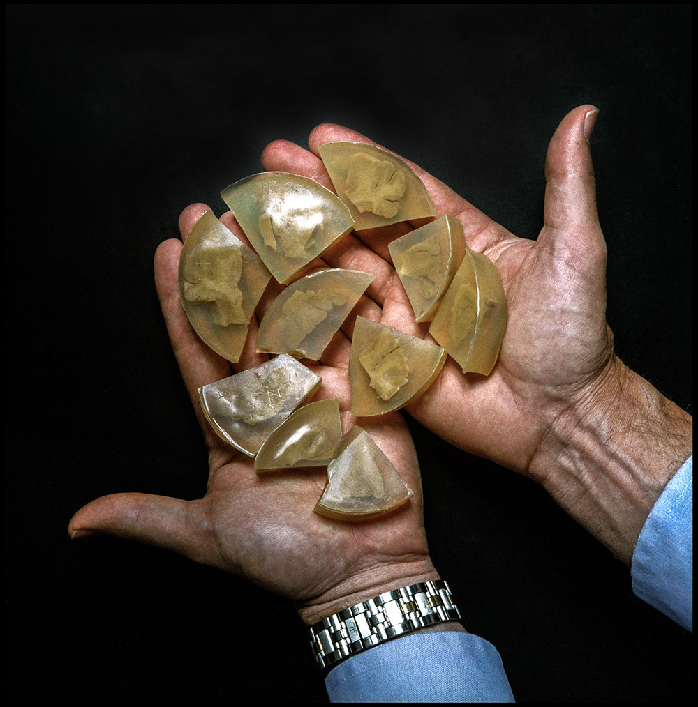 The dissected brain of physicist Albert Einstein, removed by pathologist Thomas Harvey shortly after the great scientist's death, segmented and preserved in celloidin, circa 1980