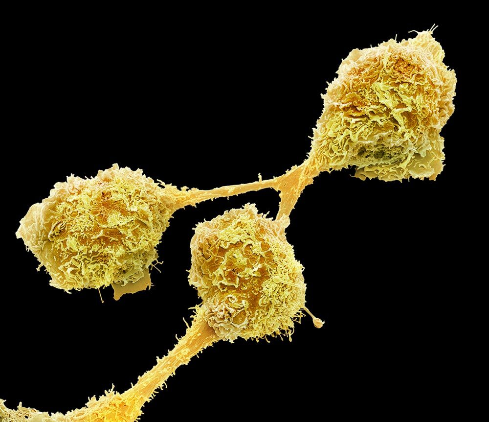 Colored scanning electron micrograph (SEM) of microglial cells, the main form of immune system in the central nervous system.