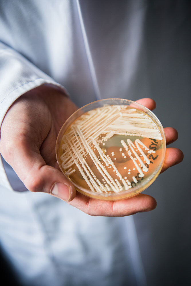 A doctor holds a petri dish with yeast