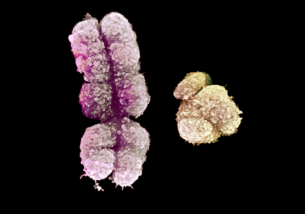 A purple, X chromosome next to a yellow Y chromosome against a black background