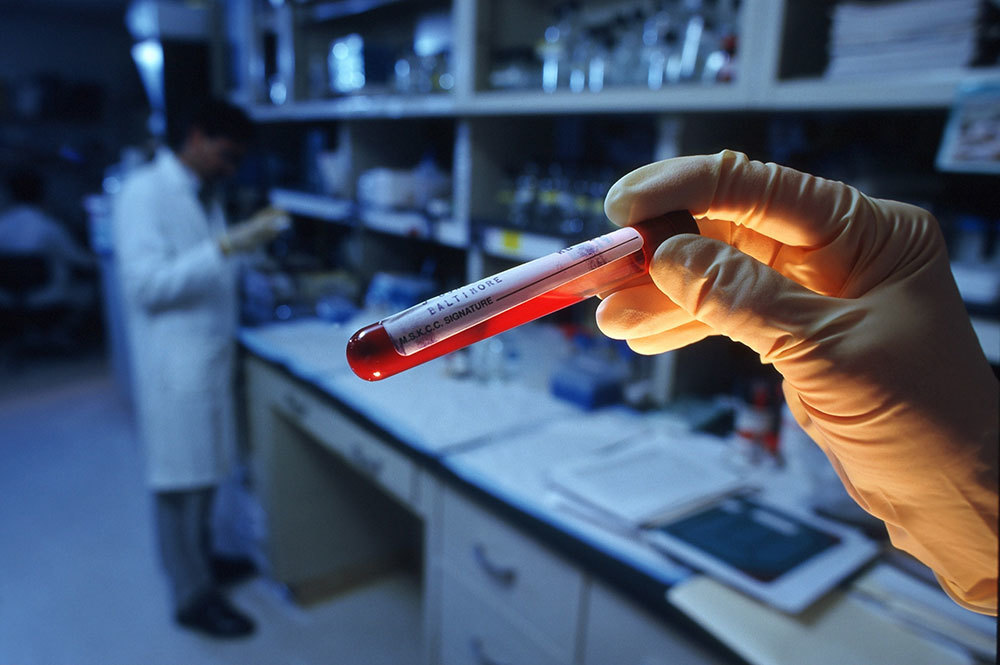 A picture of a hand holding a vial of blood