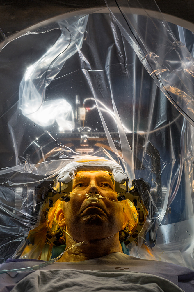 A patient with Parkinson's disease seen under clear surgical drapes during a procedure to place electrodes in their brain.