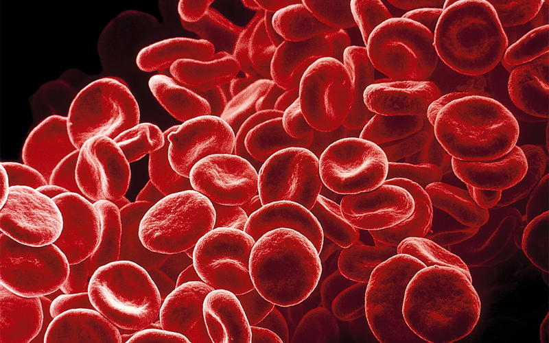 Hemoglobin within red blood cells (seen here in a colored scanning electron micrograph) allow them to transport oxygen and carbon dioxide waste between the lungs and every cell of the body. Iron is an essential component of hemoglobin, and without sufficient levels, the body struggles to meet the oxygen demands of cells. 