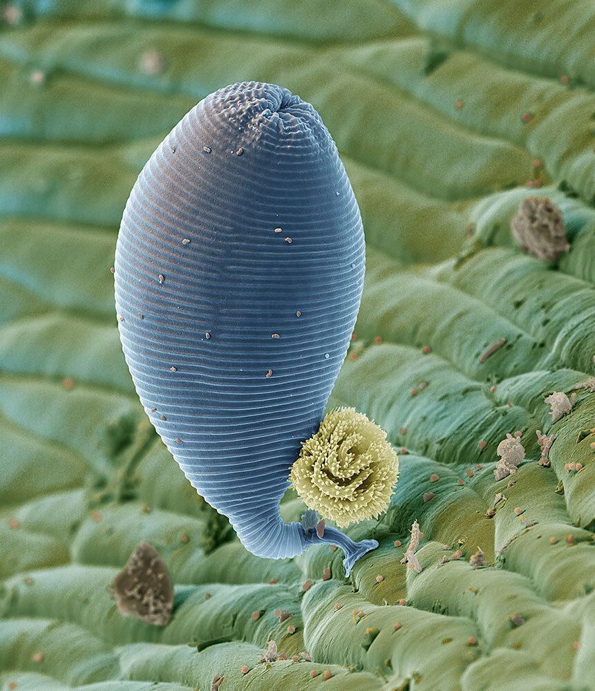 A picture of a microscopic creature that looks like balloon