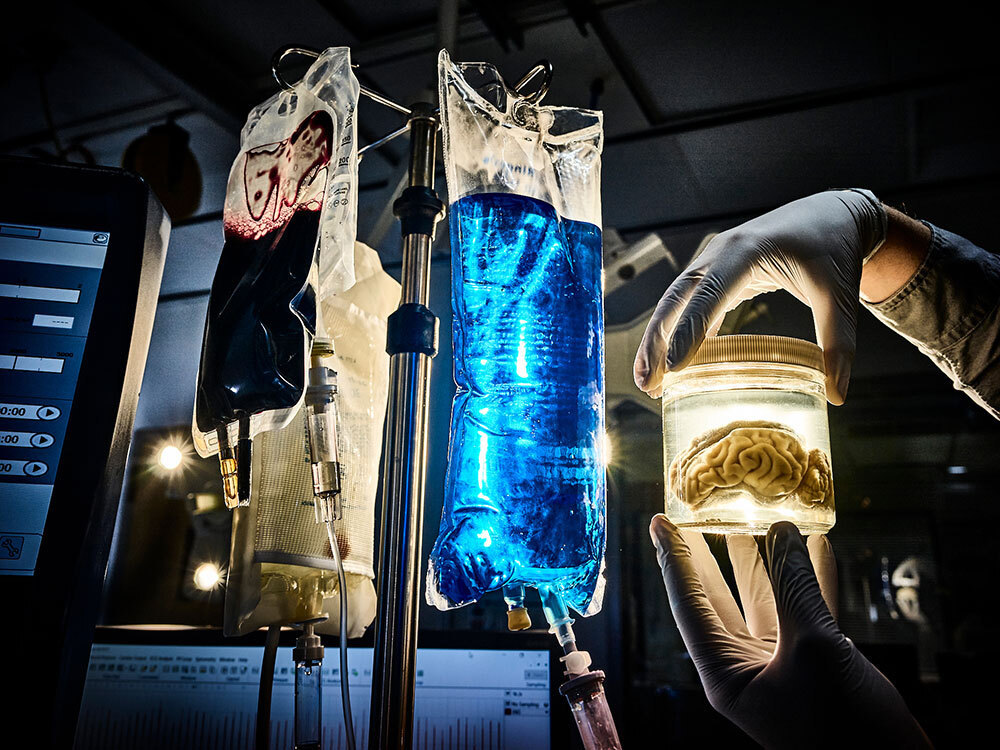 A picture of a brain in a jar next to bags of medical fluid