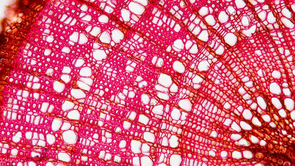 Photographed at 400 times magnification, a tree branch