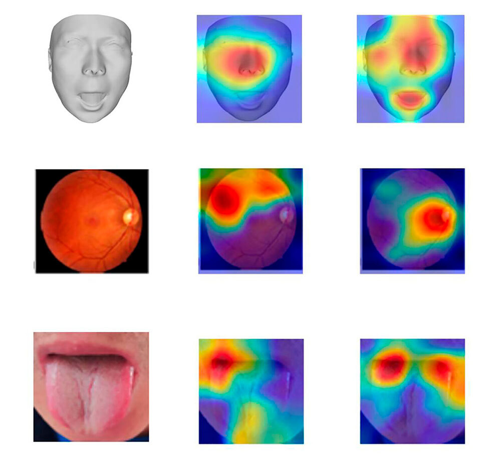 A grid of images based on the first column of a generic face, a fundoscopic view of a retina, and a photo of a tongue; the proceeding columns show map key areas for identifying age