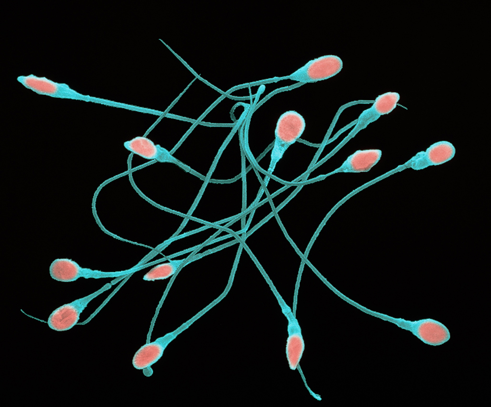 Colored Scanning Electron Micrograph (SEM) of several mature human sperm