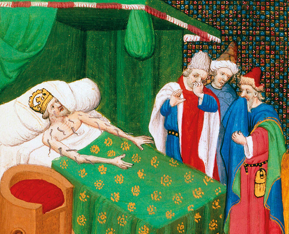 Leeches were an early method for bloodletting, as shown in this 15-century illustration from Giovanni Boccaccio’s Decameron, but the species became scarce, and more methods evolved.