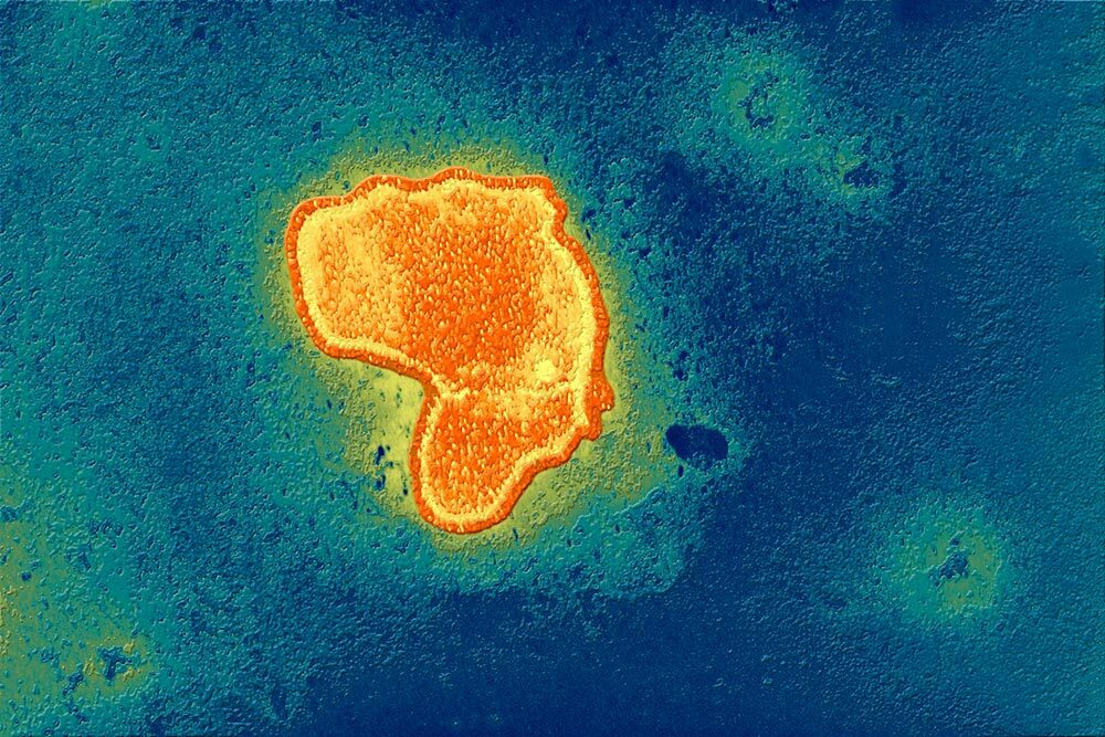 A colorized transmission electron micrograph of a respiratory syncytial virus (RSV) particle.