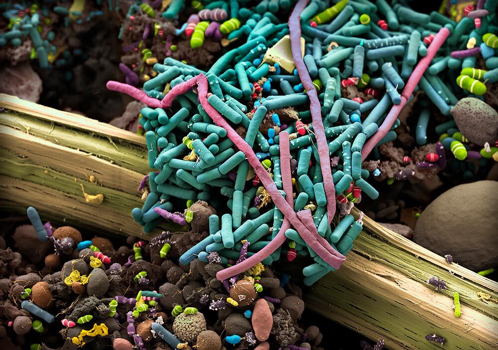 Microbes in the human gut help digest food and aid nutrient absorption, key parts of overall health. This hand-colored scanning electron micrograph reveals the large number and variability of bacteria present in human excrement.