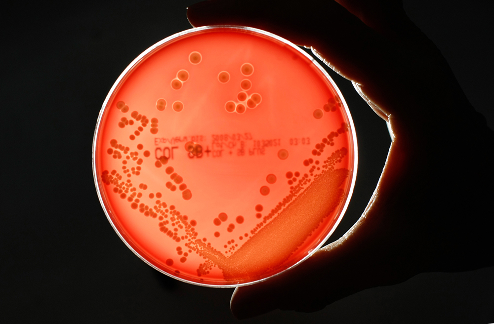 A Petri dish with a red agar base layer, which is supporting round colonies of MRSA bacteria seen scattered across its surface.