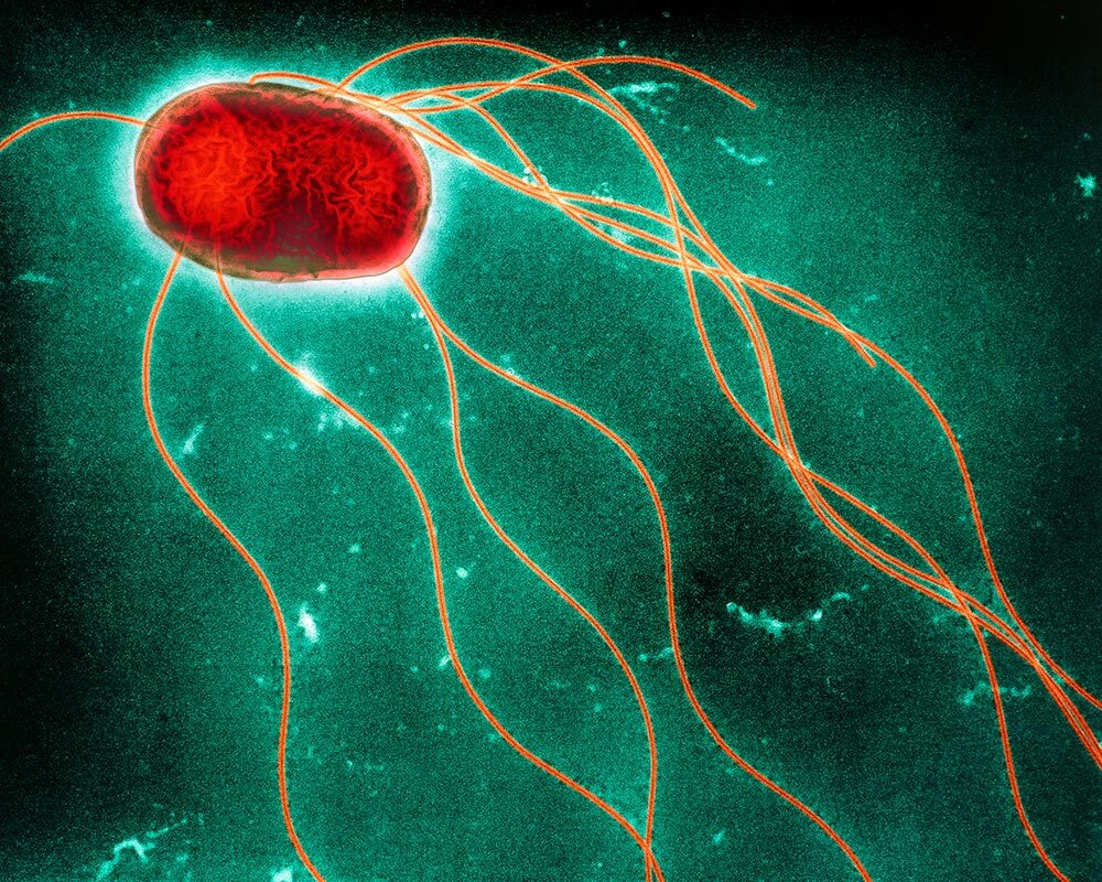 A colored transmission electron micrograph of salmonella bacteria