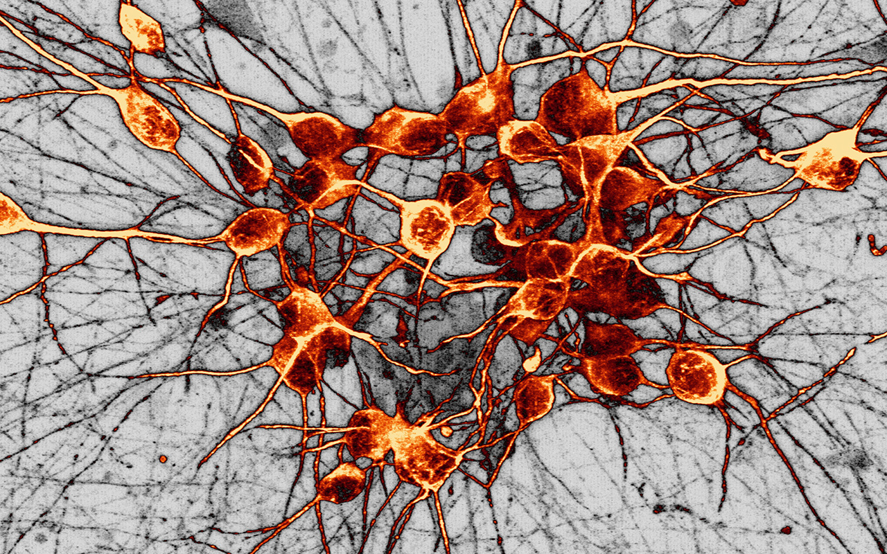 The nerve cells pictured here are responsible for producing dopamine.