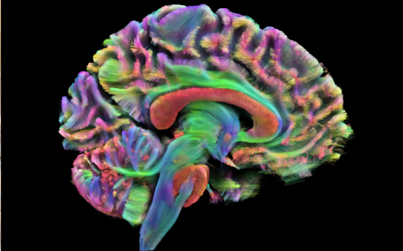 Colored diffusion tensor imaging reveals the brain’s white-matter highways 