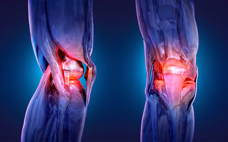 Image of bones and muscles around the knees, with the knee caps glowing red. 