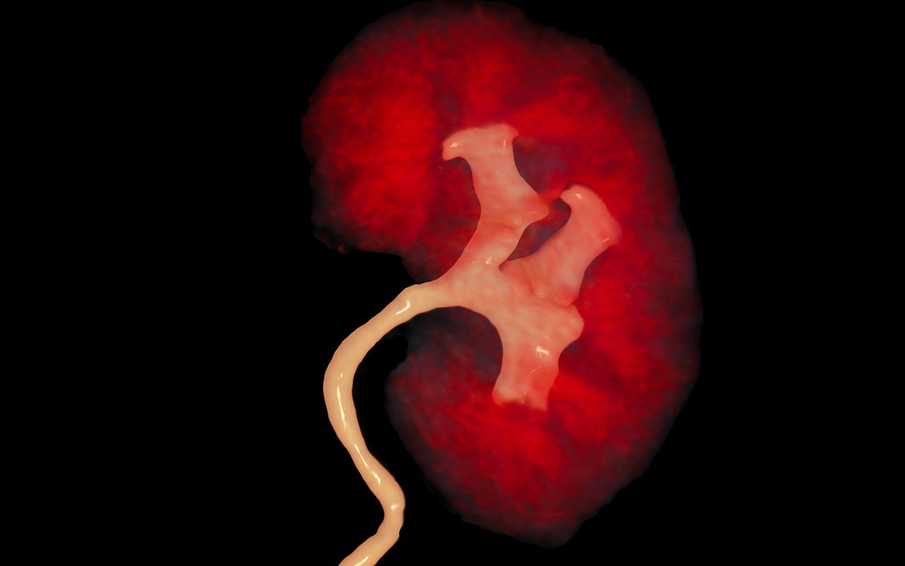 A healthy human kidney filters waste products from the blood.