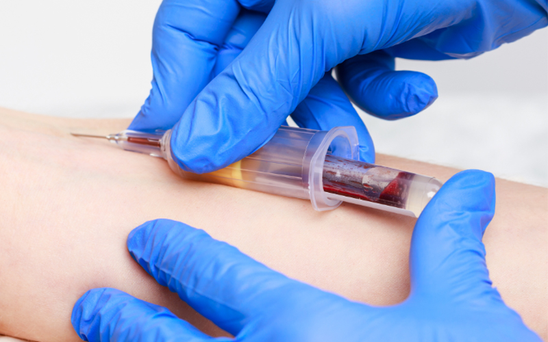 A shot of testosterone is administered in a person’s arm. 