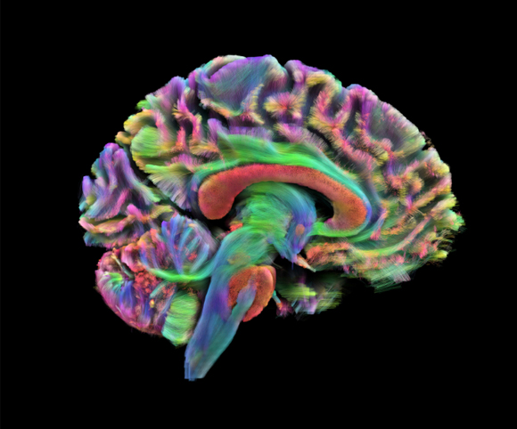 Colored diffusion tensor imaging reveals the brain’s white-matter highways, which carry signals between regions. 