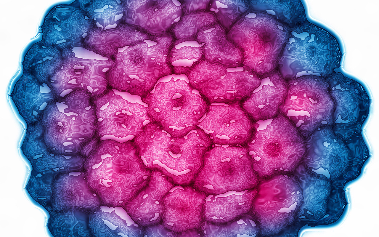 A colorized transmission electron micrograph captures HPV, the virus responsible for most cervical cancers. 