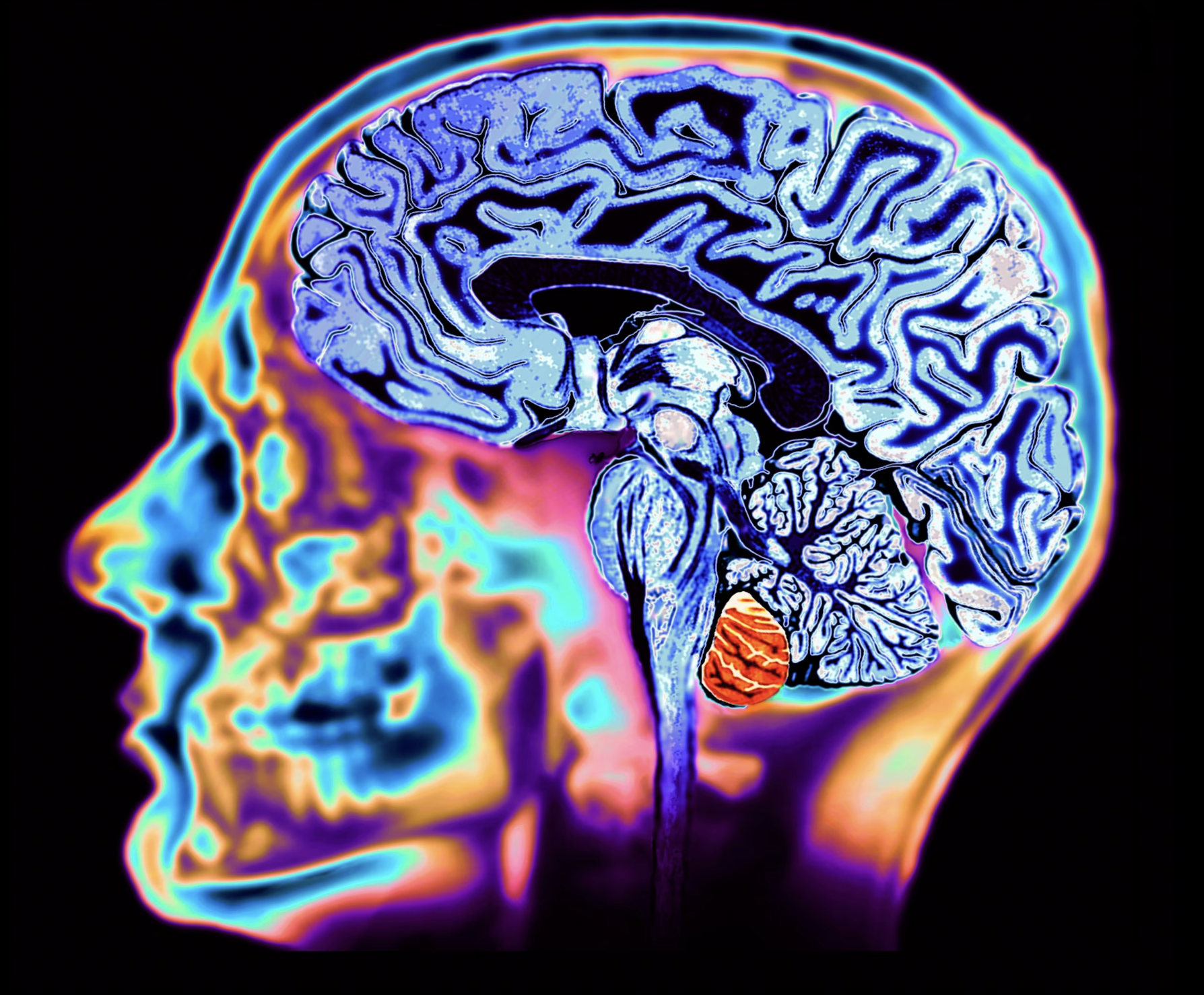 A close-up of a brain scan.